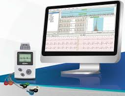 Holter EKG